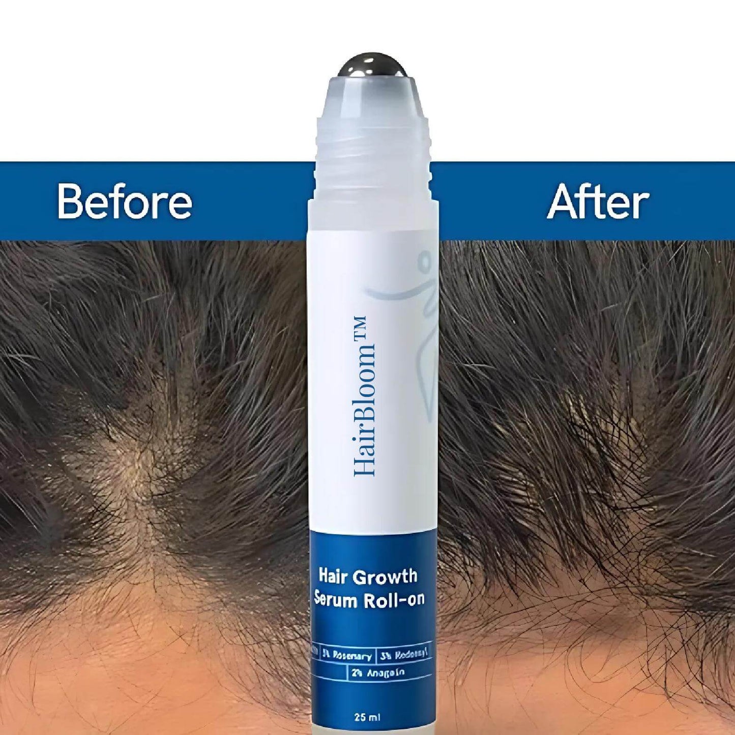 Herbal Hair Growth Serum Roll-On for Thicker, Healthier Hair
