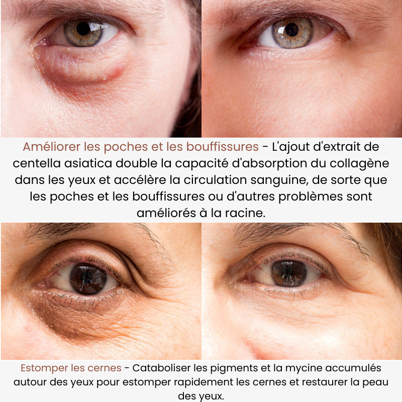 EyeShine™ - Hydrating Eye Cream for Radiant Skin