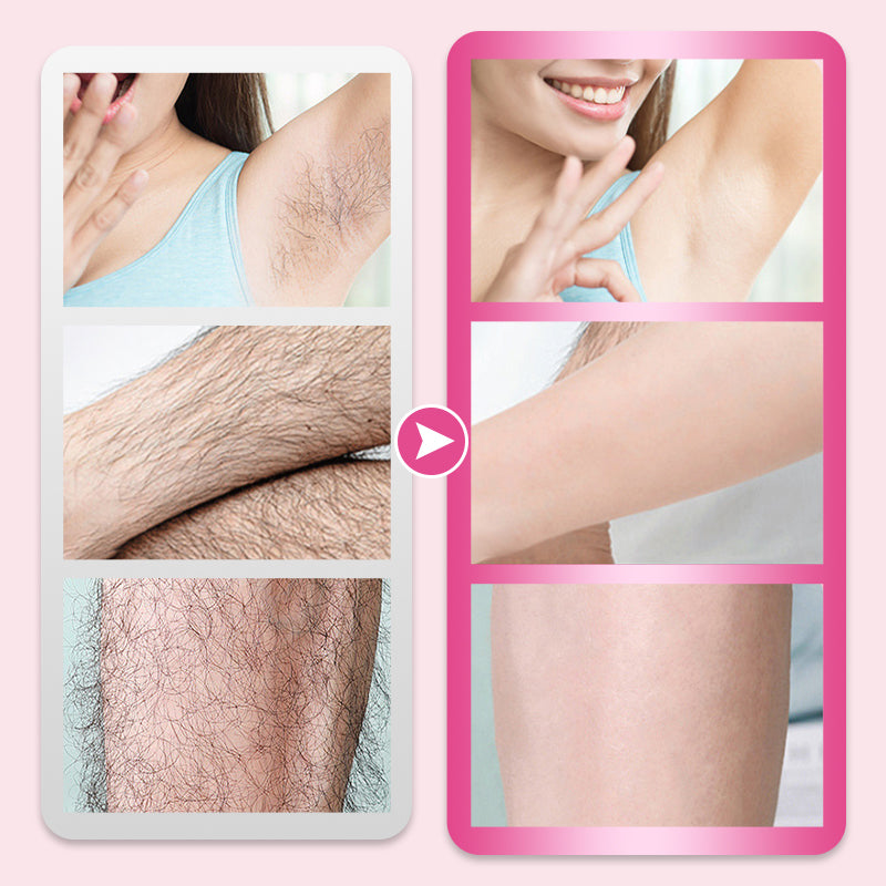 SilkEase™ - Gentle Pain-Free Hair Removal Device