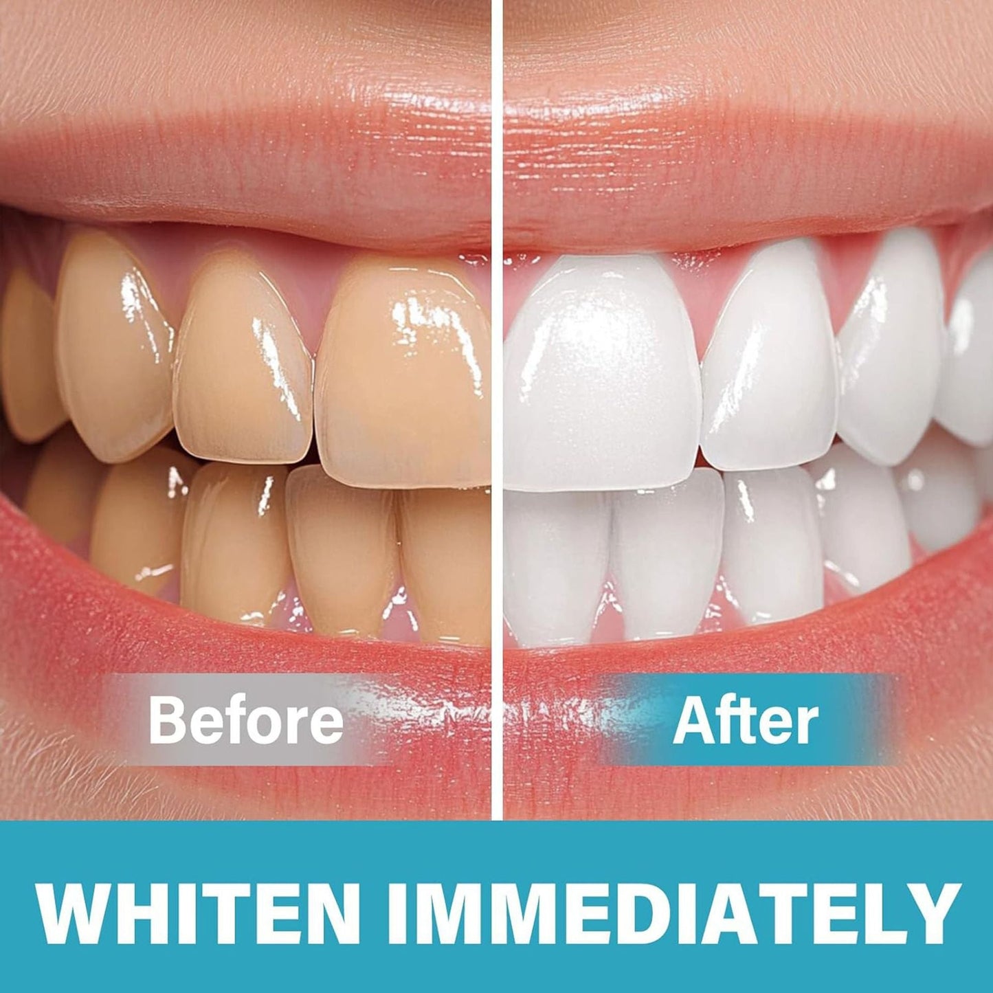 BrightSmile™ - Instant Teeth Whitening Pigment for Radiant Smile