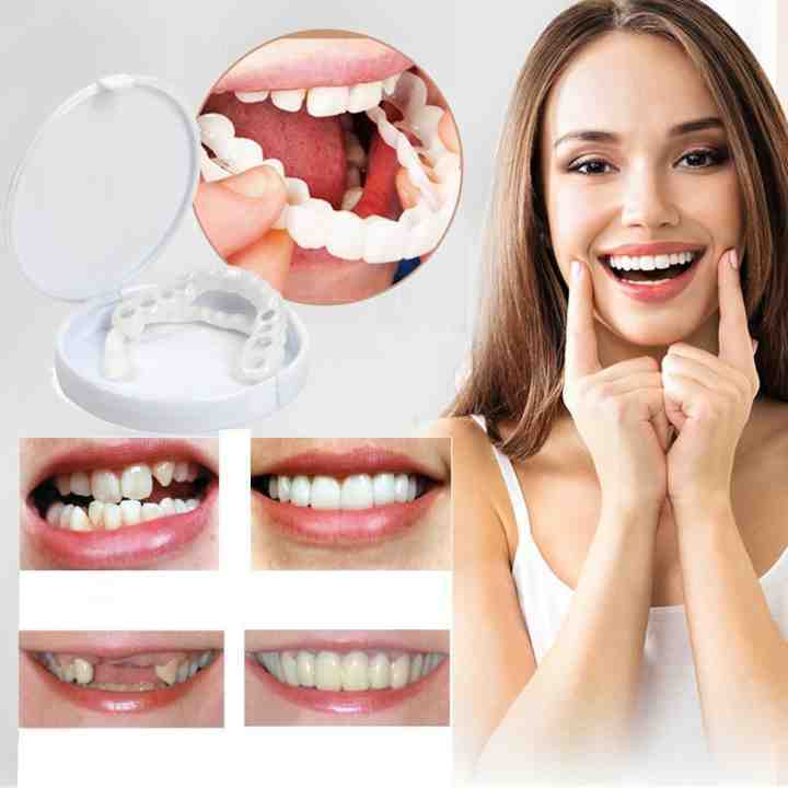 SourirePlus™ - Instant Smile Enhancer Kit