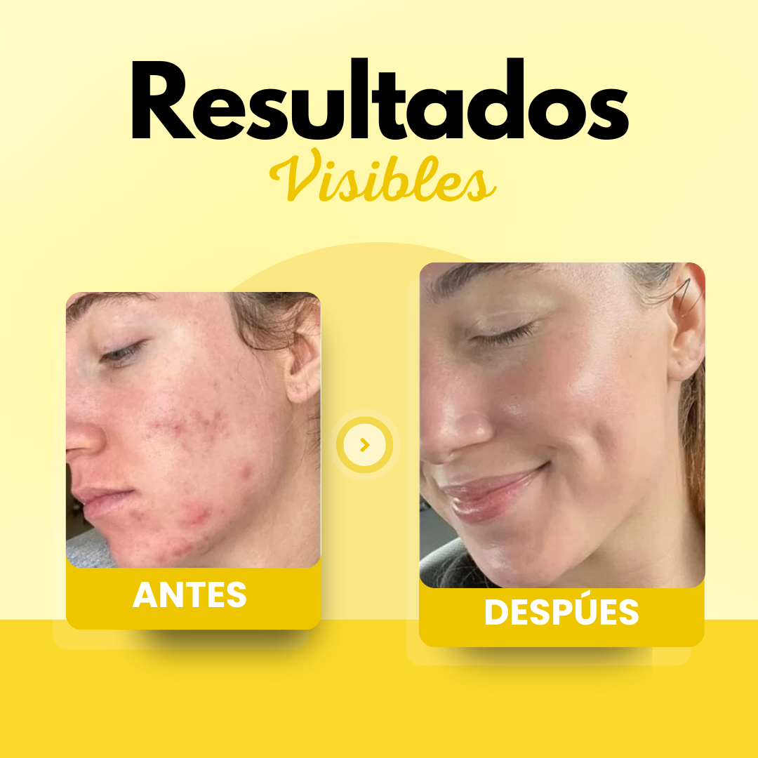 Dermaluxe - Deeply Repairs and Hydrates Sensitive, Dry Skin Instantly