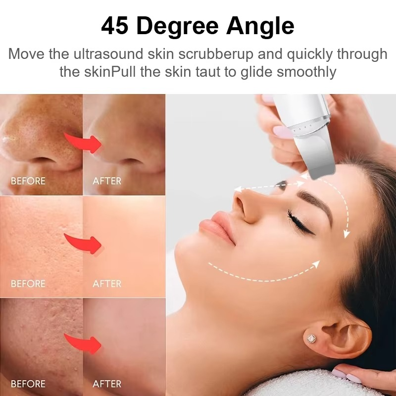 SkinSonic™ - Ultrasound Skin Scrubber for Deep Cleansing & Glow