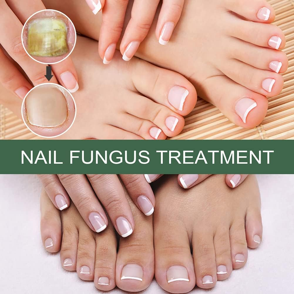 PureNail™ - Repair Serum for Damaged & Fungus-Prone Nails