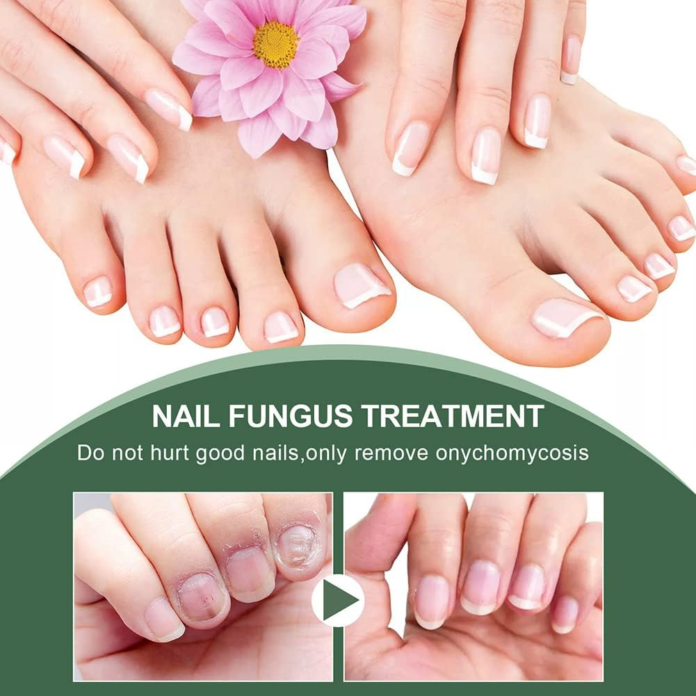PureNail™ - Repair Serum for Damaged & Fungus-Prone Nails