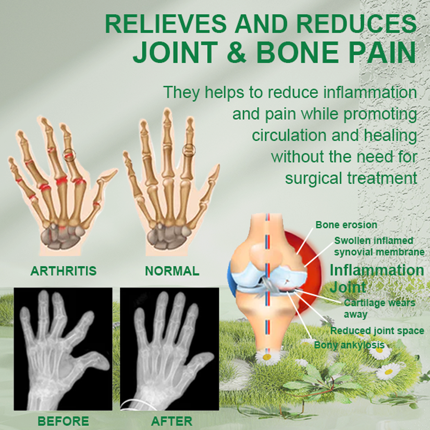 Fast-Acting Natural Pain Relief Gel for Joint and Muscle Comfort