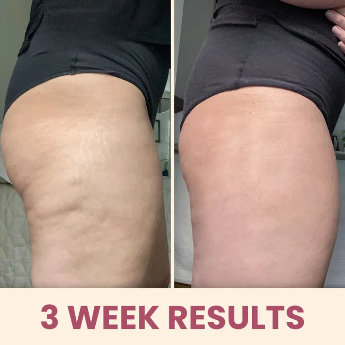MeridEase - Fast Relief from Muscle Pain and Stiffness Anywhere