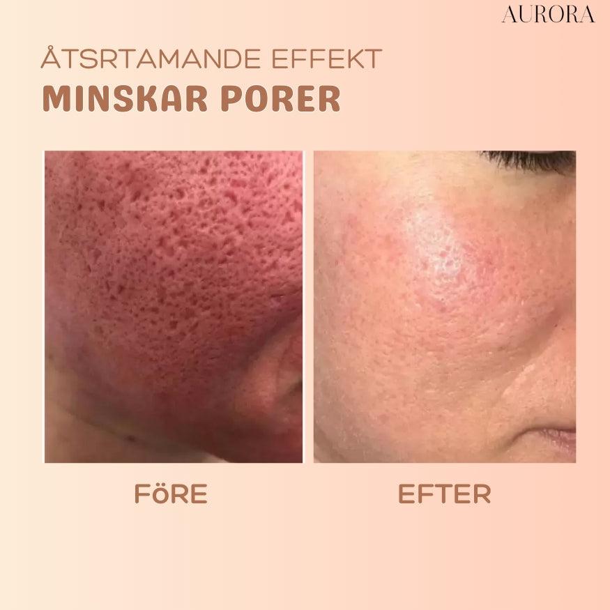 SkinSoothe - Instantly Smooth Wrinkles for Youthful Radiance