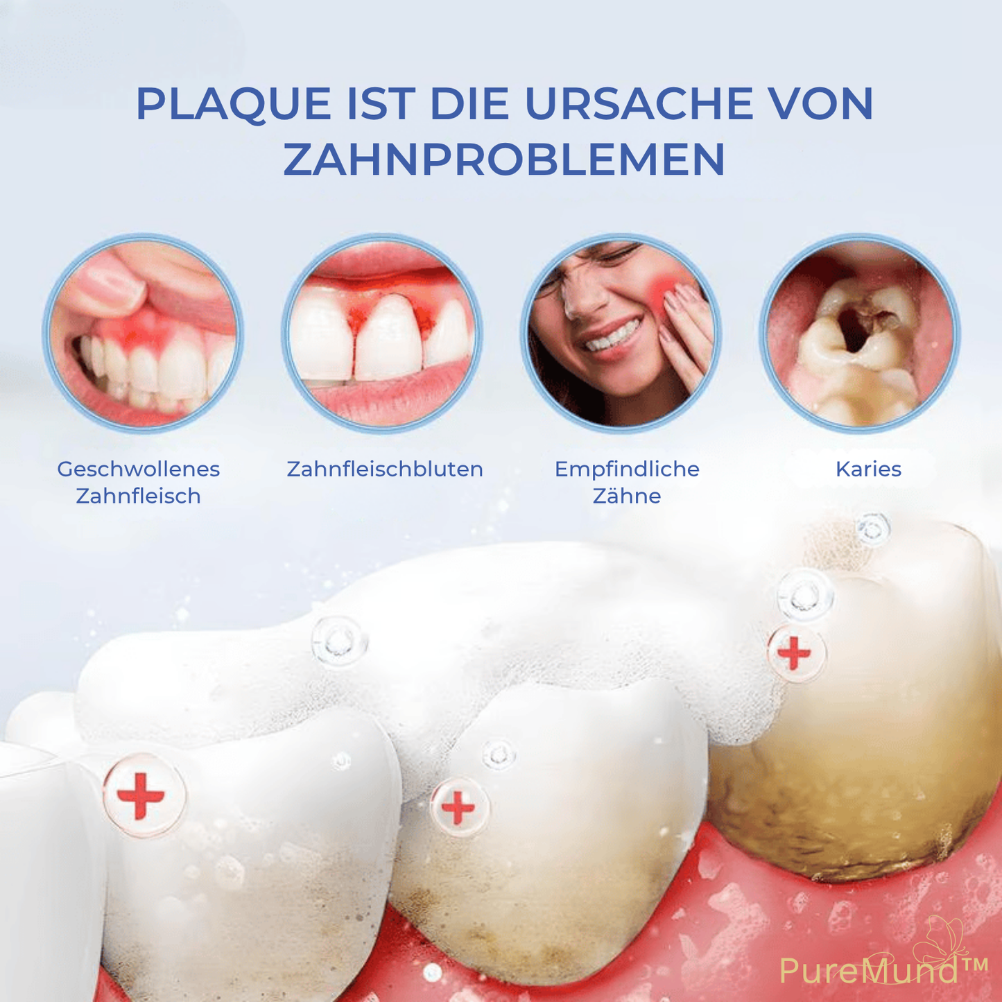 LuminoDent - Whiter Teeth Fast Without Harsh Chemicals
