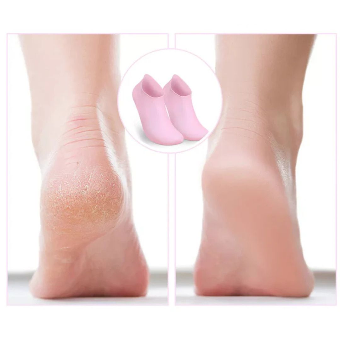 SilkSole - Wake Up to Soft, Crack-Free, Hydrated Feet Every Day
