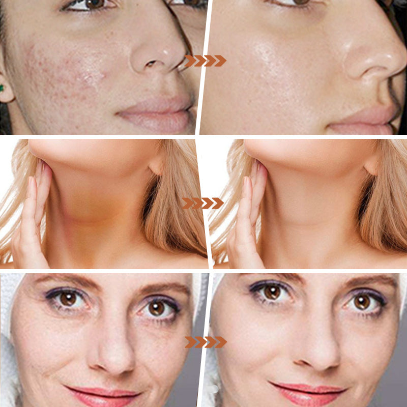 LumiGlow™ - Radiant Revival Soap for Smooth, Confident Skin