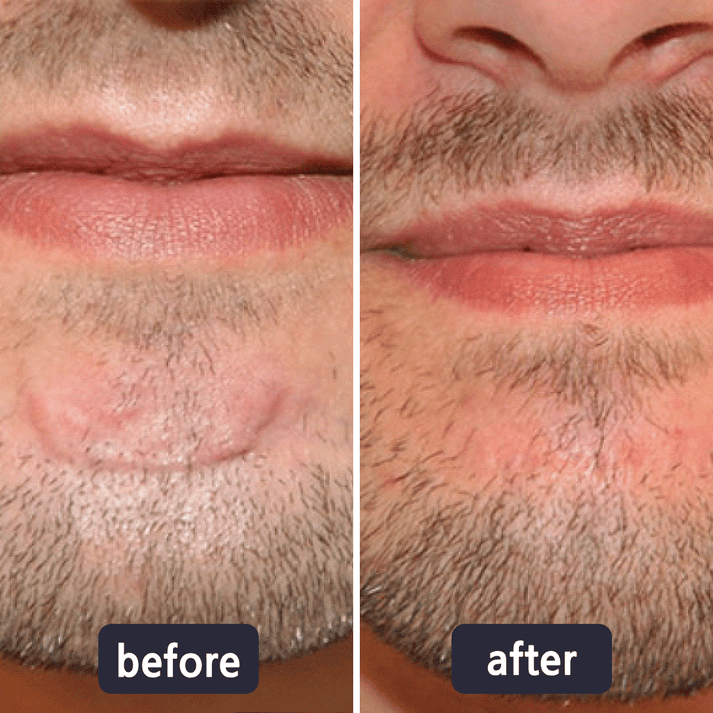 GlowVive - Fade Scars Fast and Tighten Skin for Youthful Glow