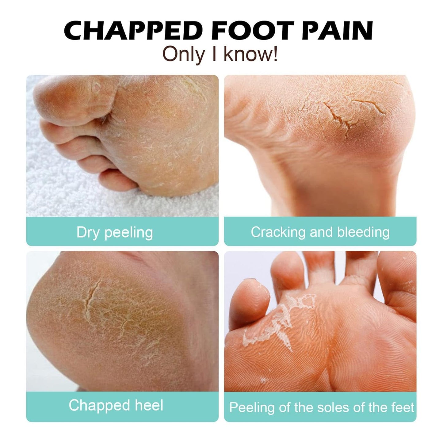 Medical Foot Care Cream™ - Heals & Protects Cracked Skin Comfortably