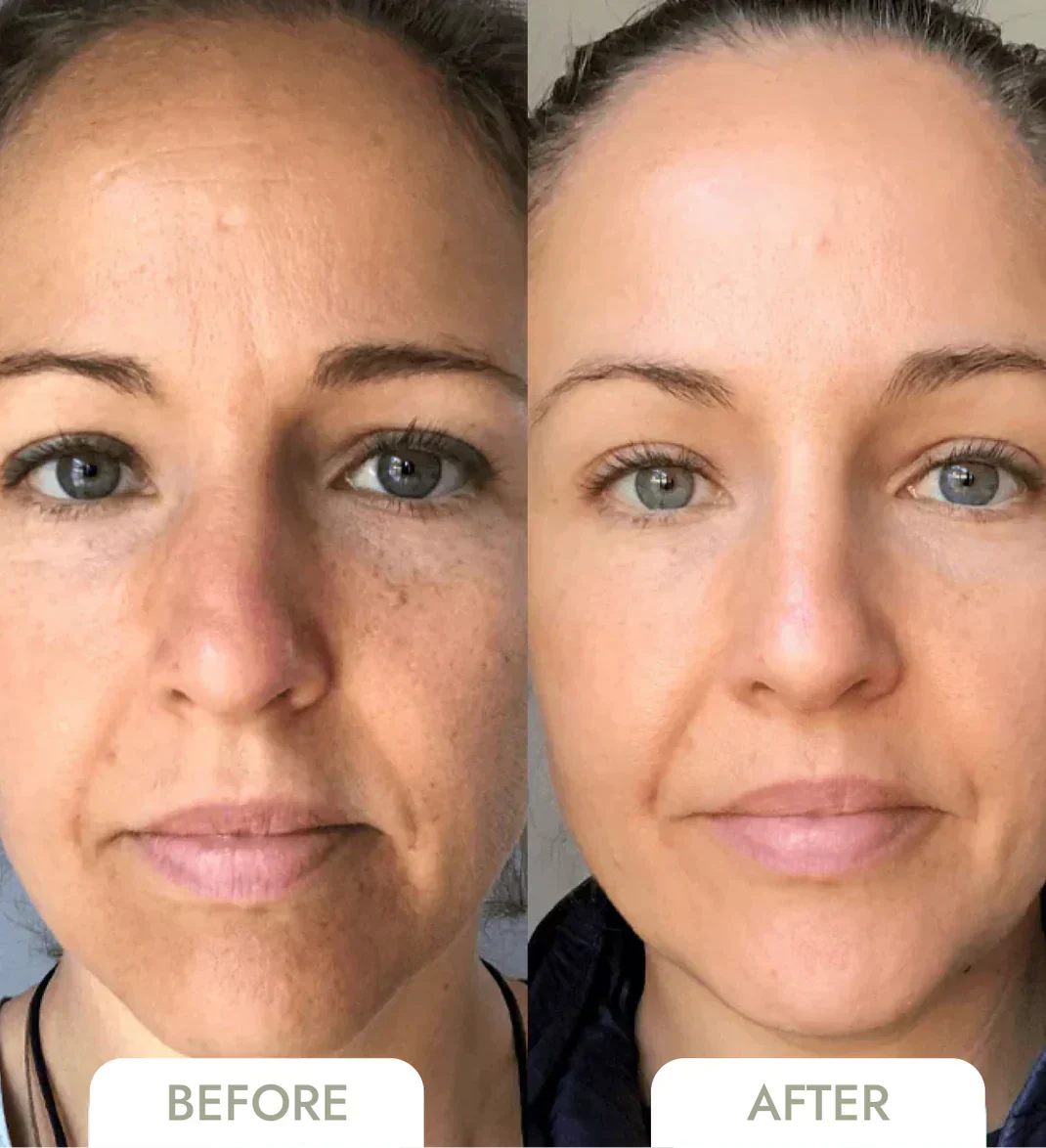 GlowSkin™ - Radiance Boosting Facial Serum