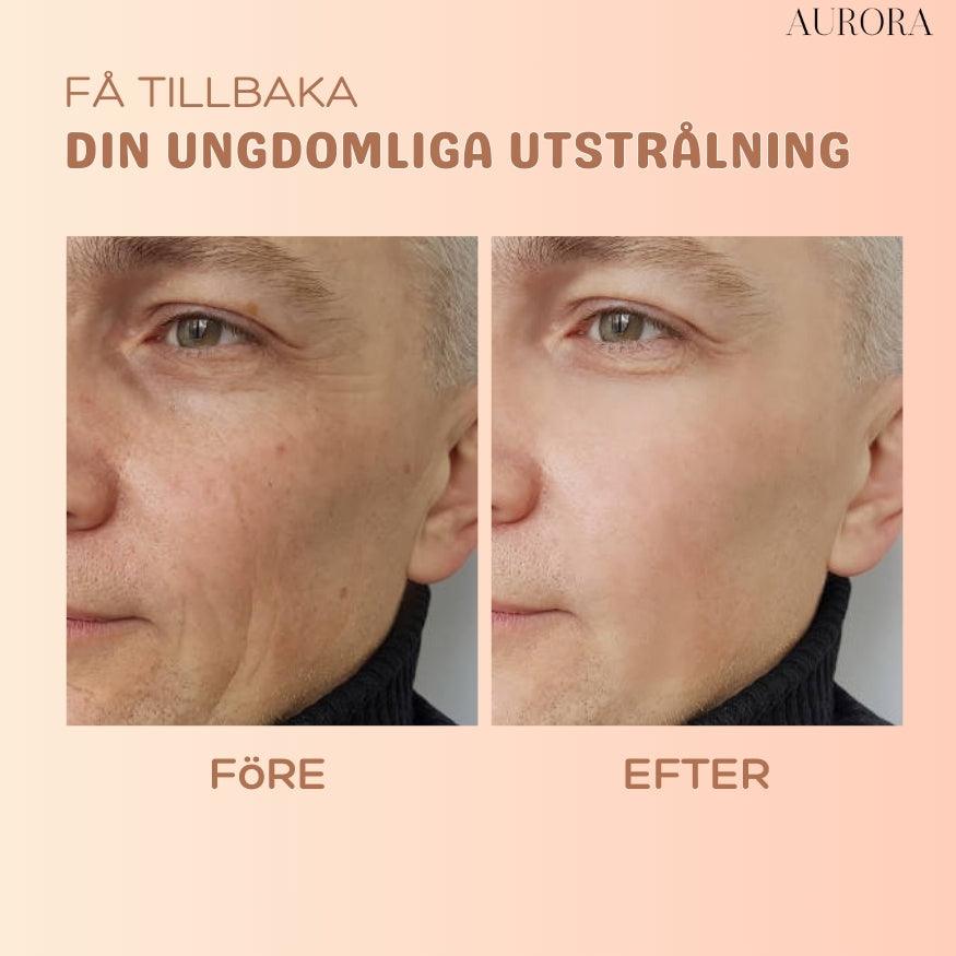 SkinSoothe - Instantly Smooth Wrinkles for Youthful Radiance