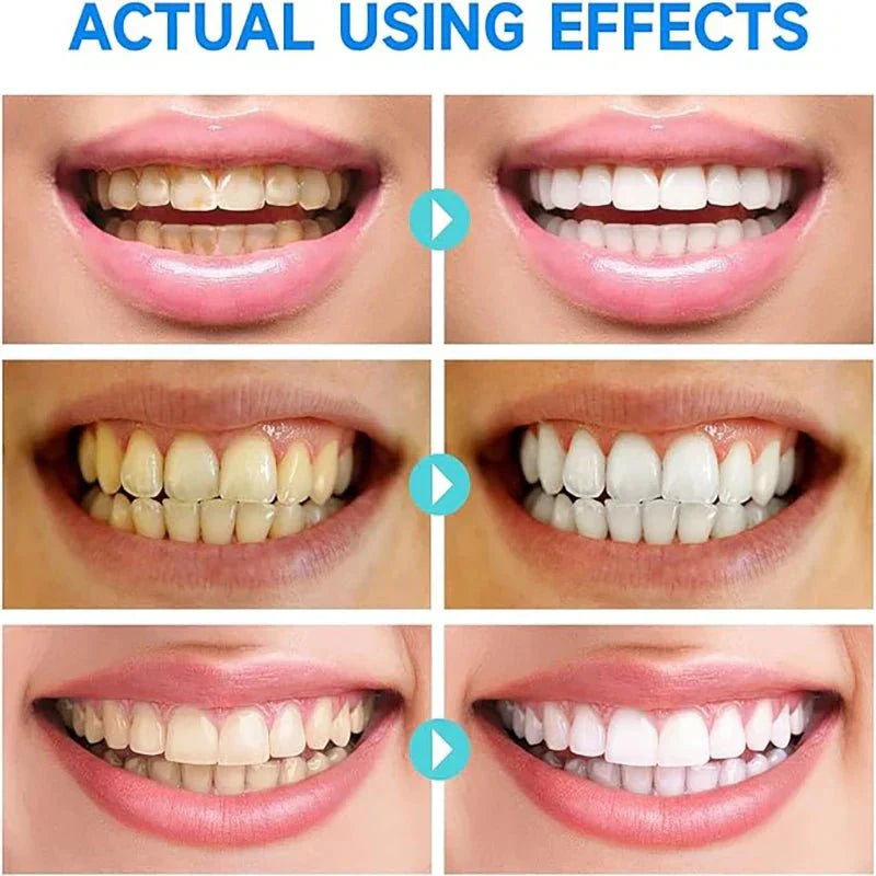 BrightMolto - Whiten Teeth, Heal Gums & Freshen Breath Fast