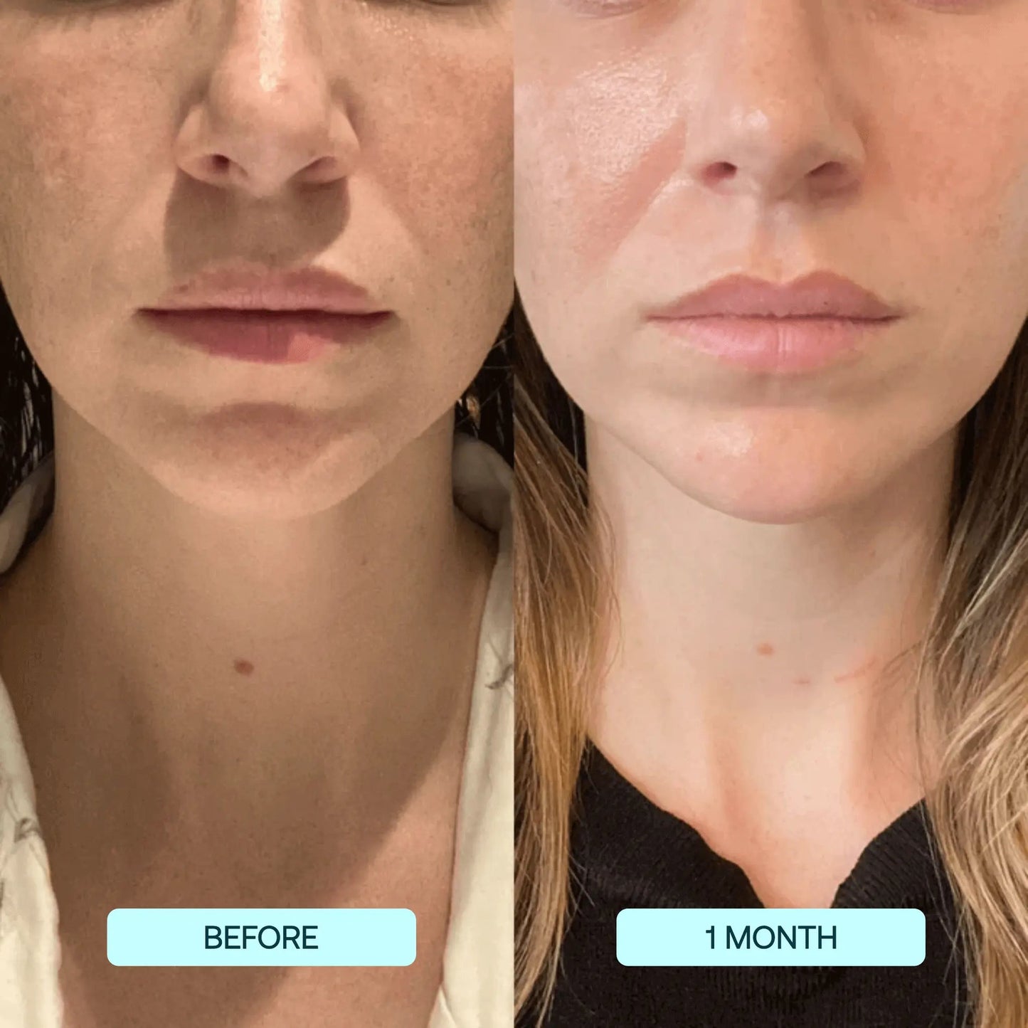 GlowSkin™ - Radiance Boosting Facial Serum