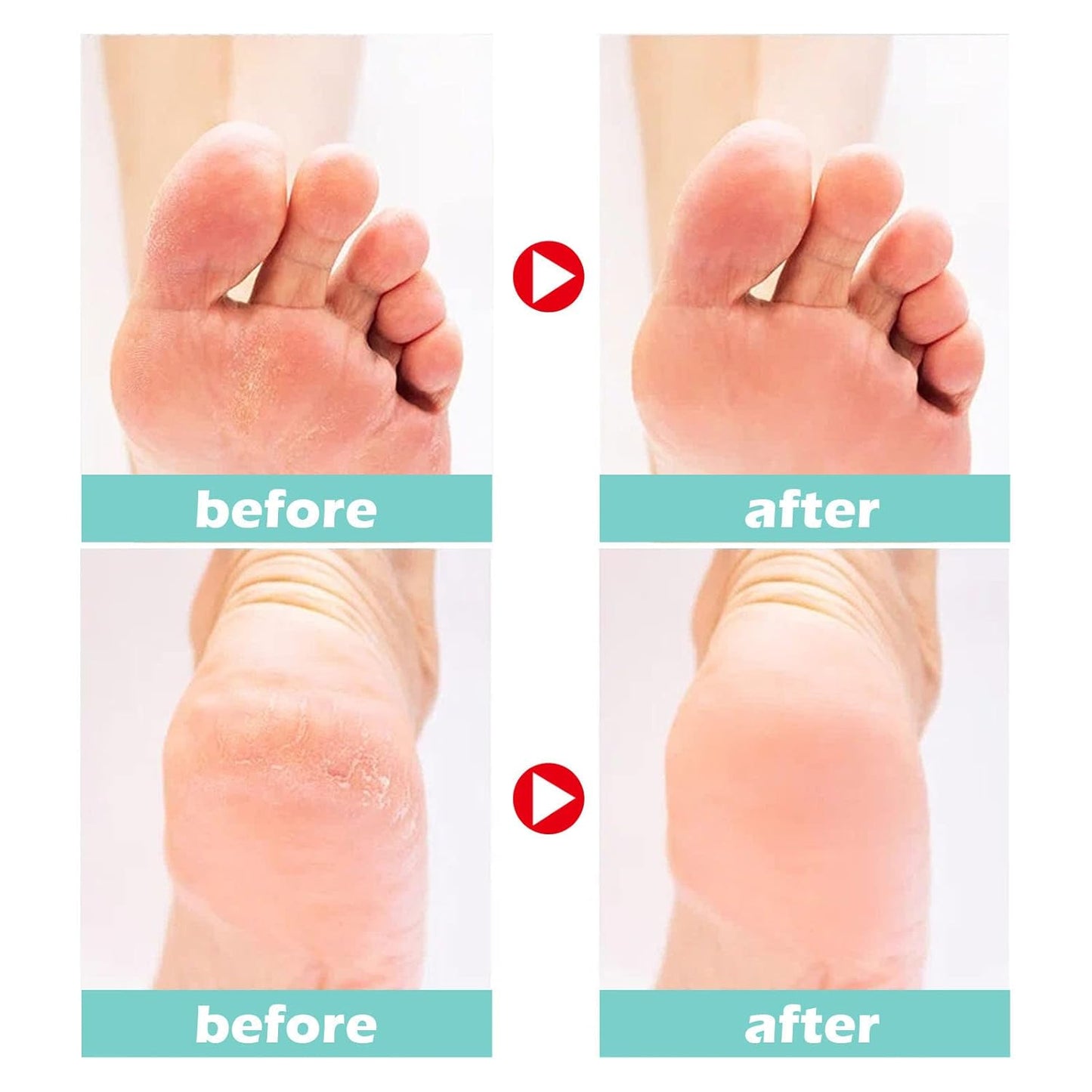 Medical Foot Care Cream™ - Heals & Protects Cracked Skin Comfortably