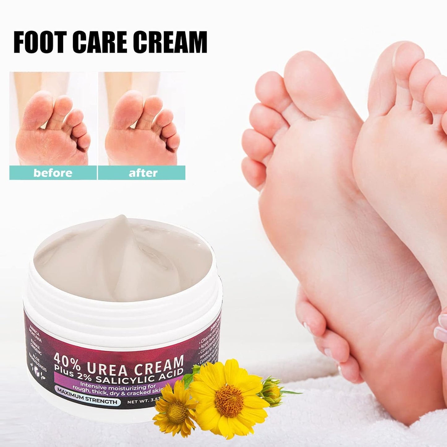 Medical Foot Care Cream™ - Heals & Protects Cracked Skin Comfortably