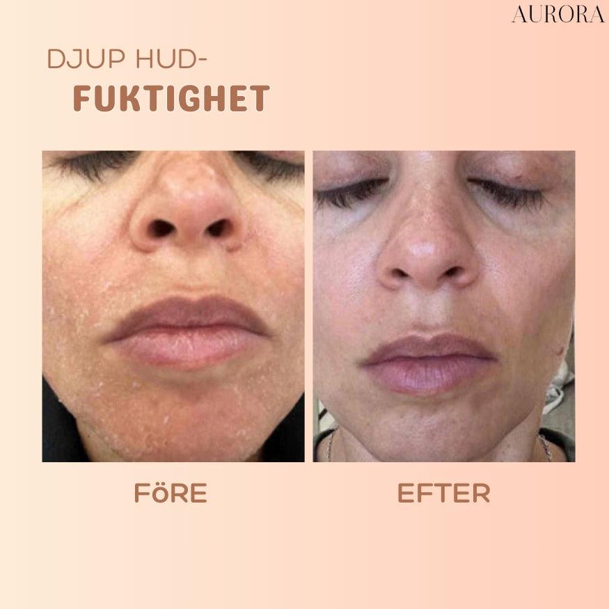 SkinSoothe - Instantly Smooth Wrinkles for Youthful Radiance