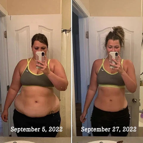 Ultrasound Slimming Device for Targeted Body Contouring