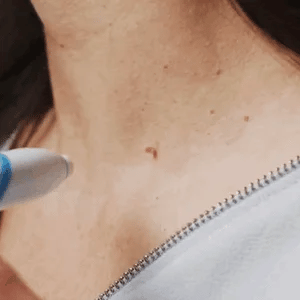 Lusail™ - Fast Auto Tag Removal Kit