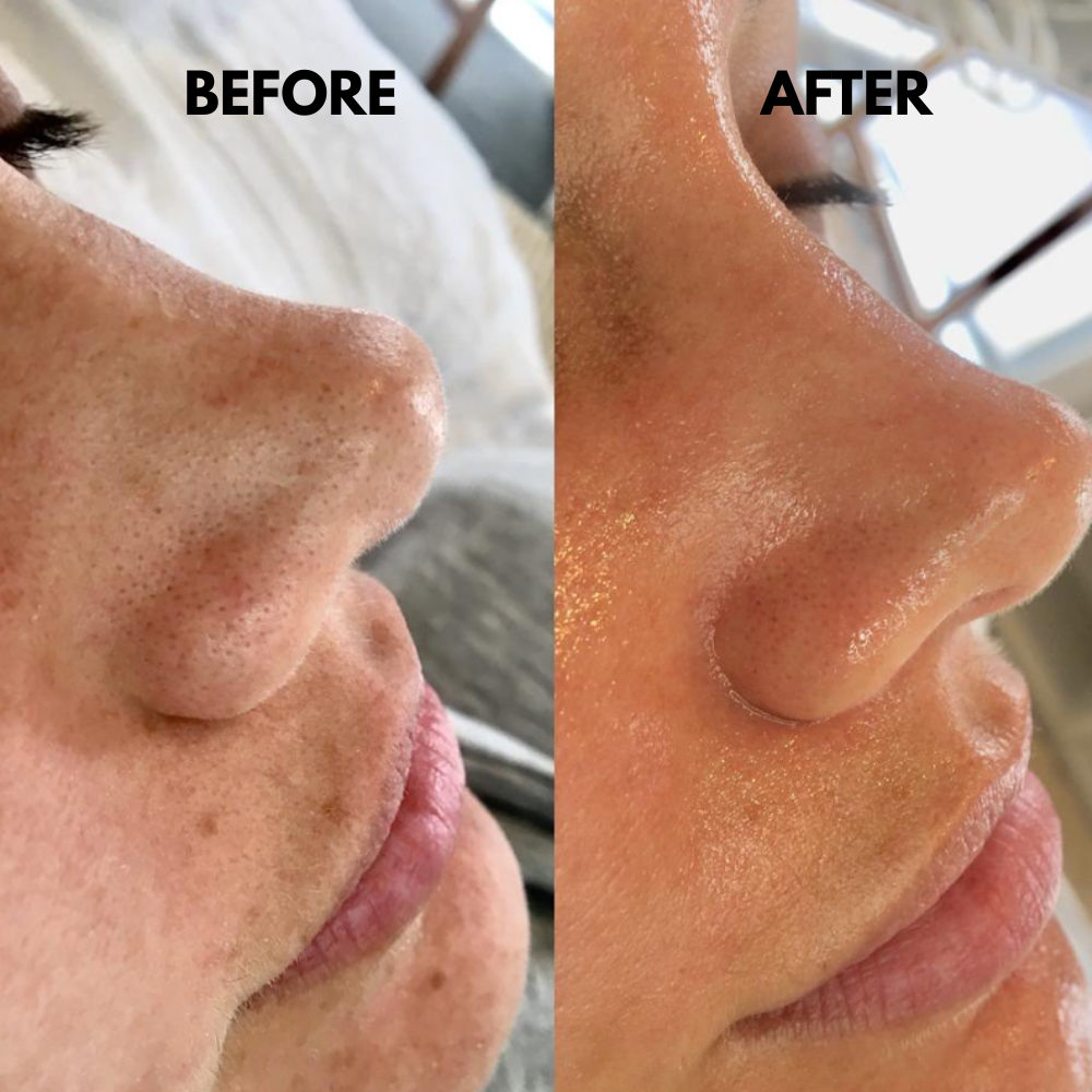 SkinSonic™ - Ultrasound Skin Scrubber for Deep Cleansing & Glow