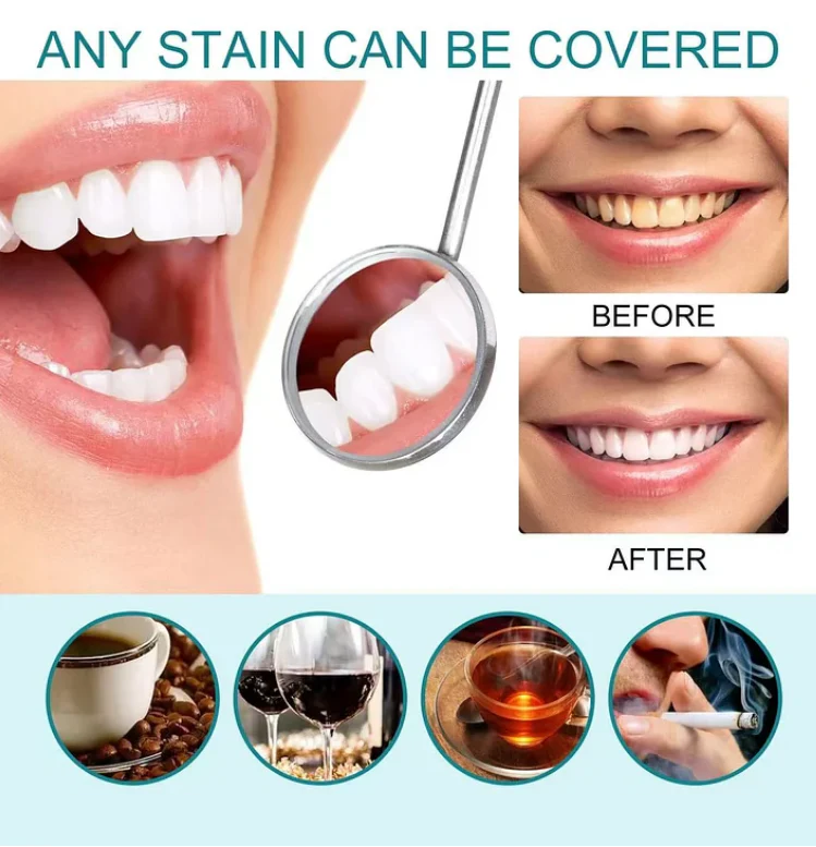 LuminaWhite™ - Instant Yellow Stain Neutralizer