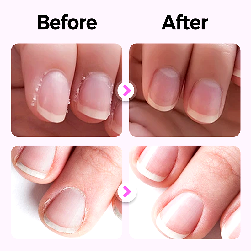 3-in-1 Nail Care Pen for Smooth, Shiny Nails