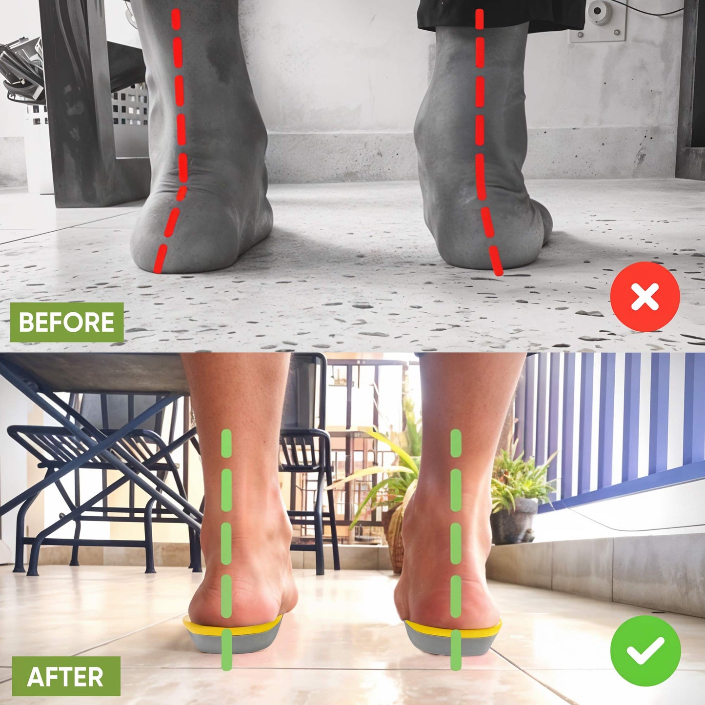 StrideEase - All-Day Comfort and Relief for Aching Feet