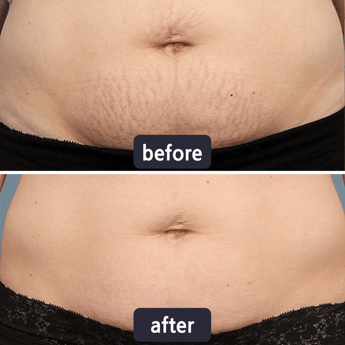 GlowVive - Fade Scars Fast and Tighten Skin for Youthful Glow