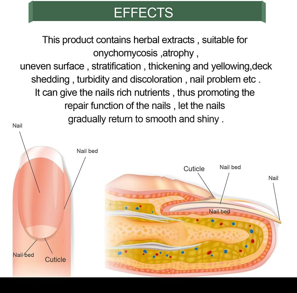 PureNail™ - Repair Serum for Damaged & Fungus-Prone Nails