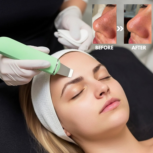 SkinSonic™ - Ultrasound Skin Scrubber for Deep Cleansing & Glow