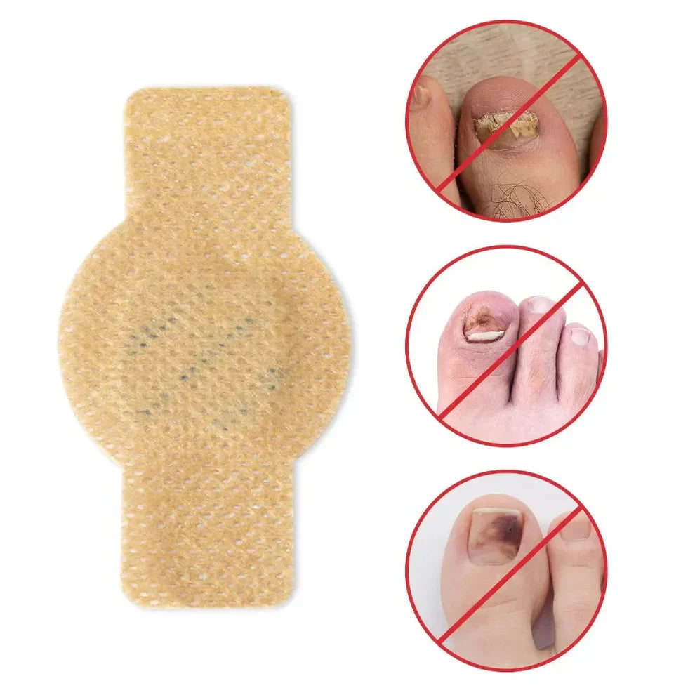 FungiCare™ - Easy-Apply Nail Repair Patches