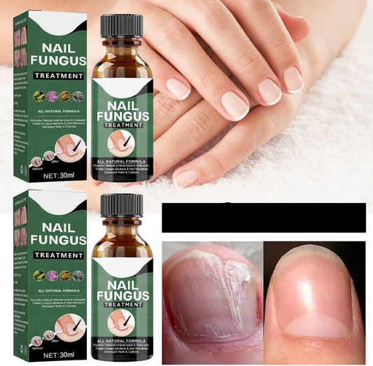 PureNail™ - Repair Serum for Damaged & Fungus-Prone Nails
