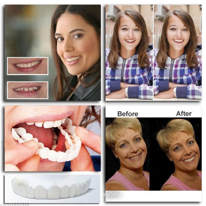 SourirePlus™ - Instant Smile Enhancer Kit