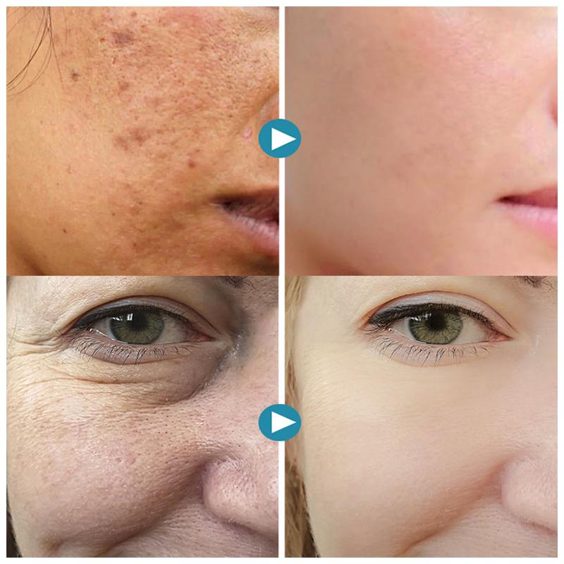Silkrēa - Instantly Smooths Skin for a Flawless Natural Glow