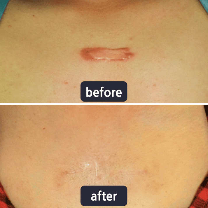 GlowVive - Fade Scars Fast and Tighten Skin for Youthful Glow