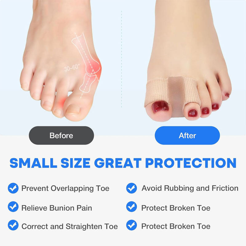 FlexiStep™ - Comfortable Toe Corrector Sleeve
