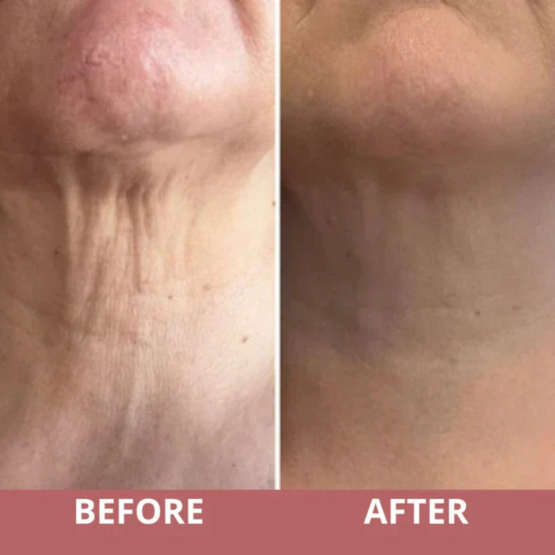NexLift - Smooth Neck Wrinkles Fast for Radiant, Youthful Skin