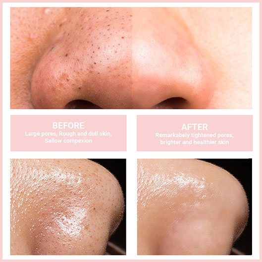 GlowPure™ - Gentle Facial Cleanser Device for Radiant Skin