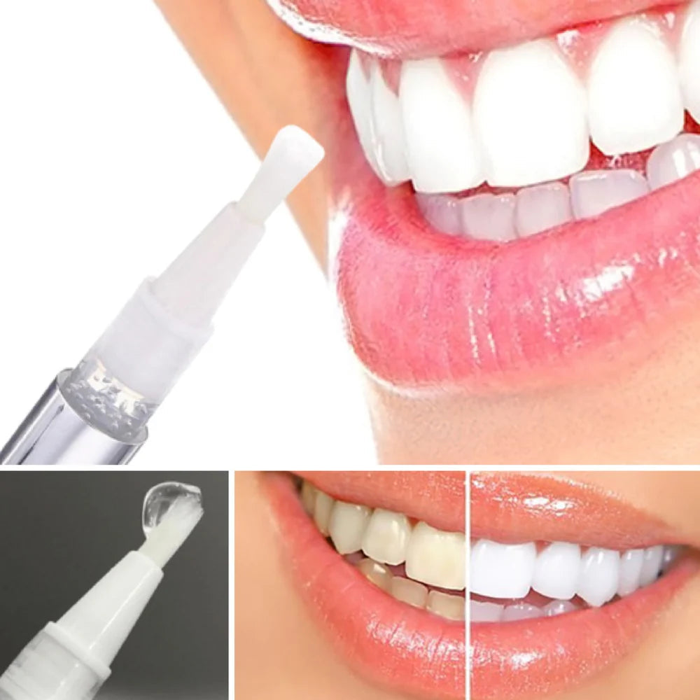 WhiteBoost™ - Teeth Whitening Pen for a Radiant Smile