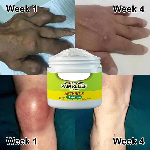 Fast-Acting Natural Pain Relief Gel for Joint and Muscle Comfort