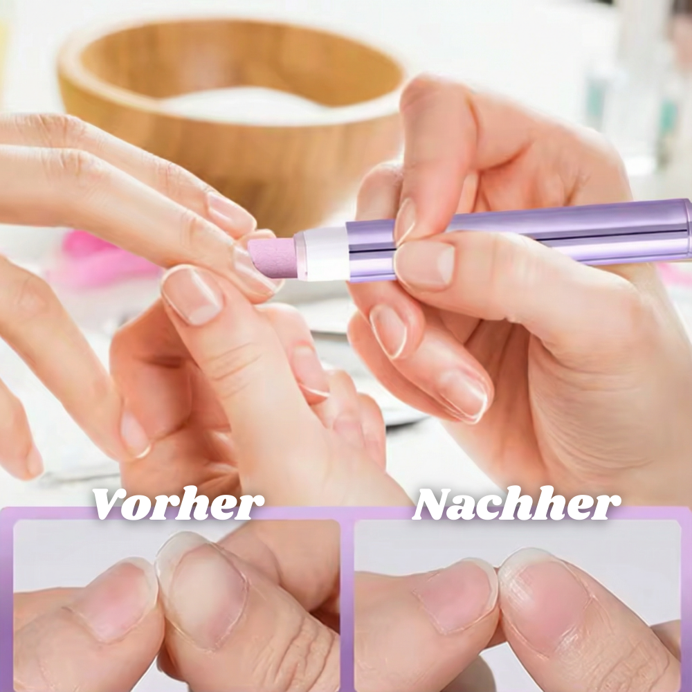 Nairoel™ - Dead Skin & Cuticle Care Stick