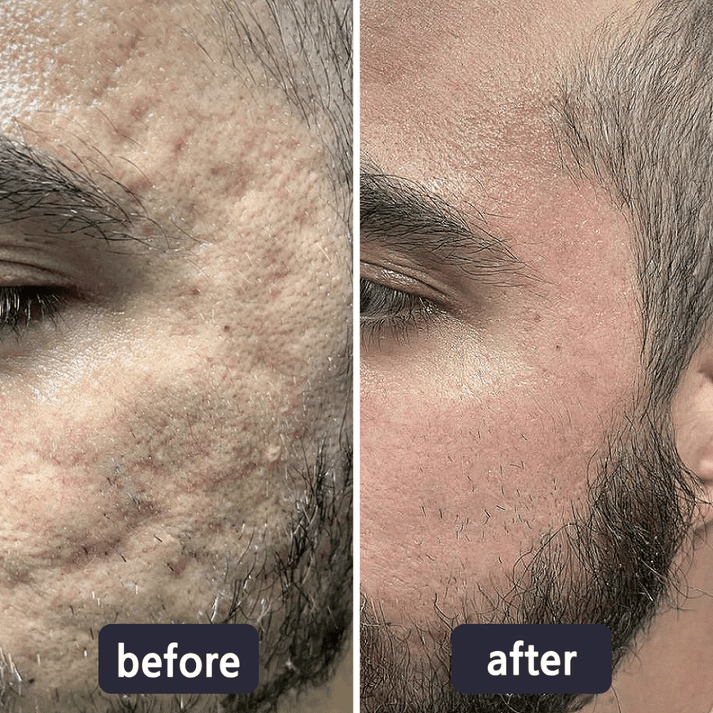 GlowVive - Fade Scars Fast and Tighten Skin for Youthful Glow